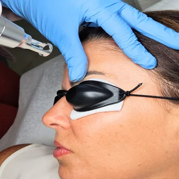 Laser Tattoo Removal Indian Creek